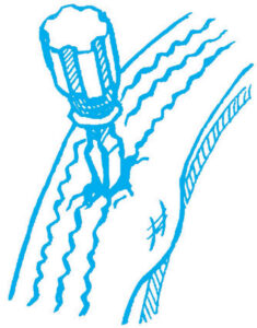 illustration of a screwdriver pressed in to a bubble in a bike tire